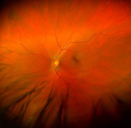 Retina Care Specialists Durango, CO - Southwest Eye Care - ophthalmologist near me - Retina Care Specialists 